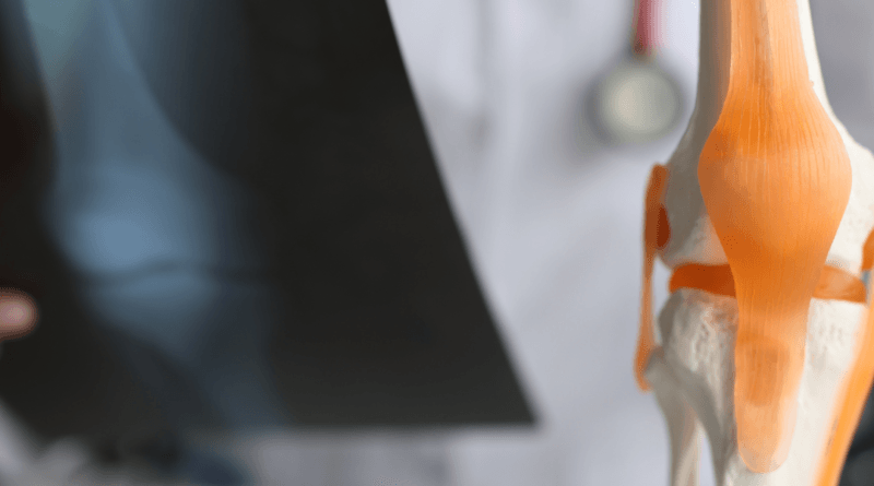 Los 5 Mejores Traumatólogos en Cuernavaca